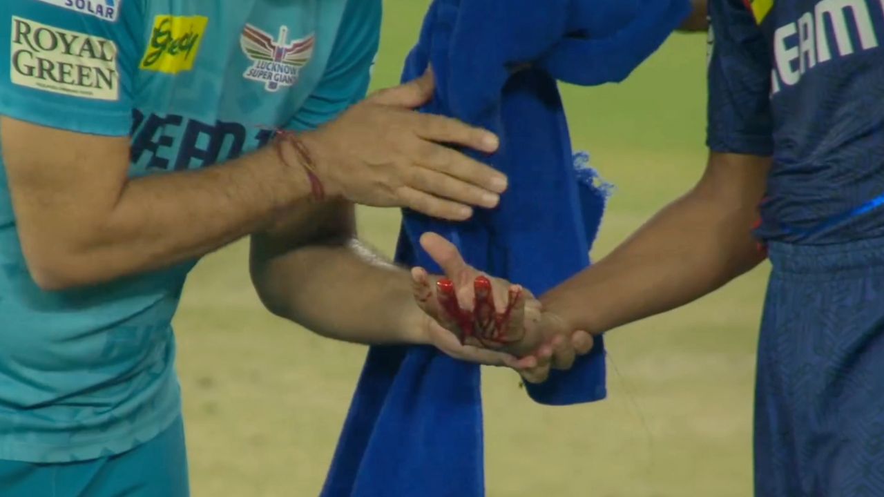 Akash Singh Hand Bleeding After Being Hit By Shubman Gill