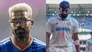 India Players Injury List Full Fitness Update On Jasprit Bumrah Hardik Pandya And More