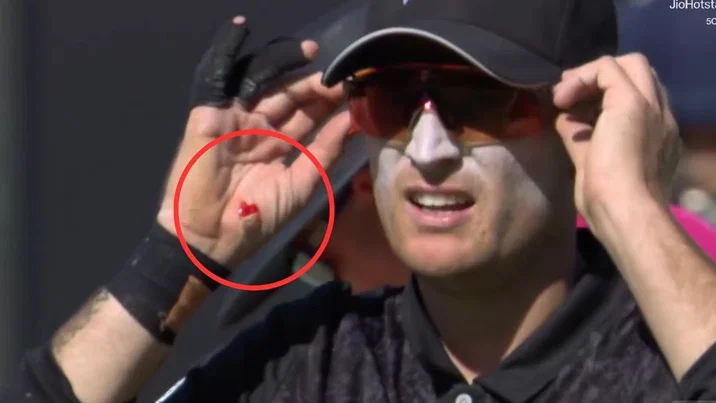 Jayden Lennox Walks Off Bleeding After Taking Virat Kohli Bullet 1