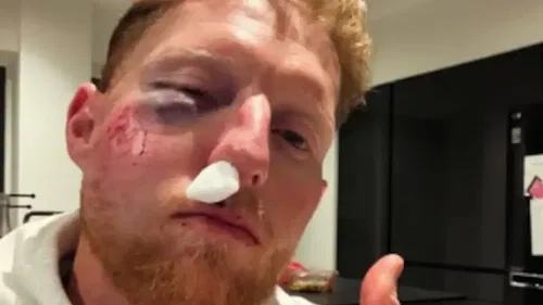 Ben Stokes swears by helmet after frightening facial blow